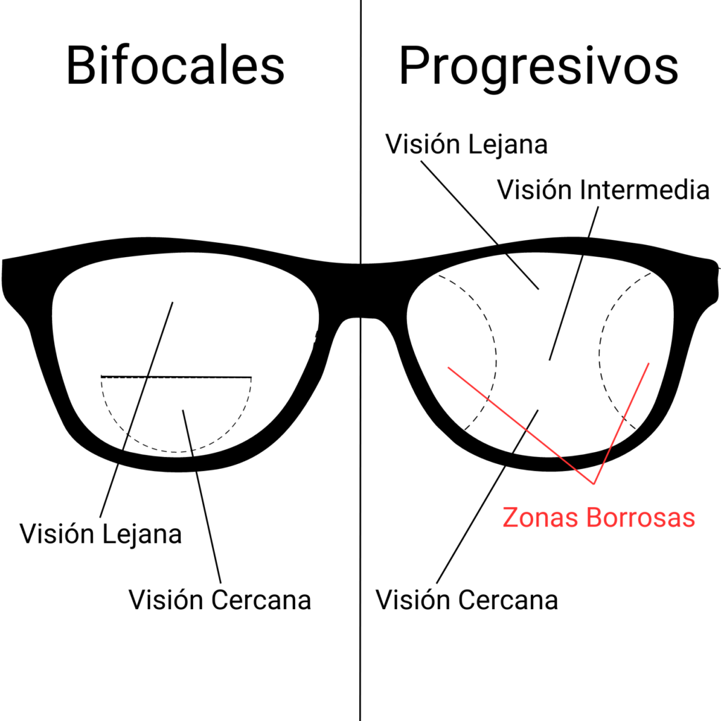 Óptica explica lentes bifocales simples y progresivas generativas ia